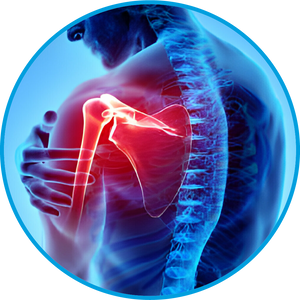 Shoulder Pains